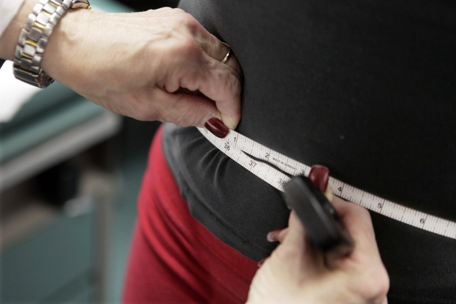 Severe Obesity on Rise in US, While Overall Rates Remain Steady