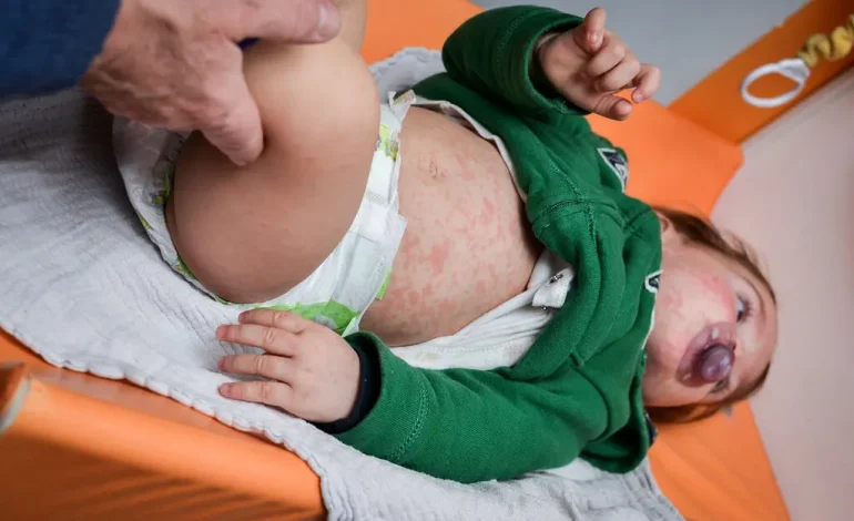 Six Childhood Illnesses We’ve Almost Forgotten, Thanks to Vaccines